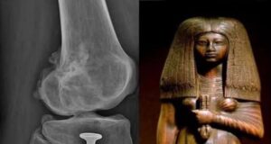 Penemuan Menarik: Kajian Mumi Wanita Mesir Berusia Lima Puluhan