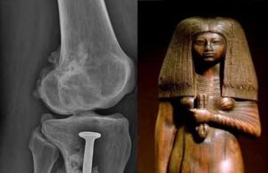 Penemuan Menarik: Kajian Mumi Wanita Mesir Berusia Lima Puluhan