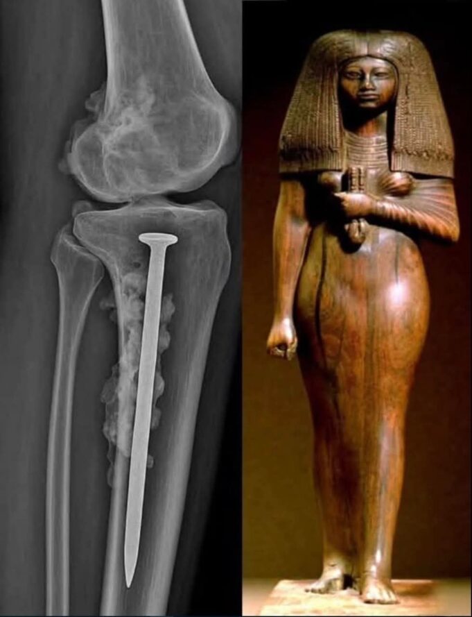 Penemuan Menarik: Kajian Mumi Wanita Mesir Berusia Lima Puluhan