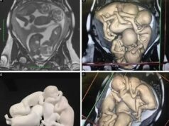 Pengalaman Seorang Wanita Berumur 32 Tahun dalam Menghadapi Cabaran Kesihatan Reproduksi