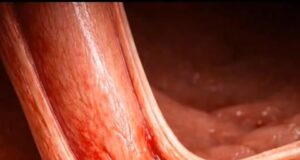 Pentingnya Kesedaran dan Tindakan terhadap Isu Alam Sekitar