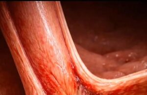 Pentingnya Kesedaran dan Tindakan terhadap Isu Alam Sekitar