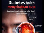 Kencing Manis: Ancaman Tersembunyi pada Kesihatan Kaki