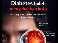 Kencing Manis: Ancaman Tersembunyi pada Kesihatan Kaki