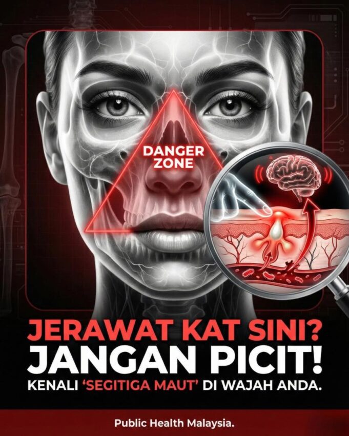Pantang Jerawat: Dilema Gatal yang Menggoda