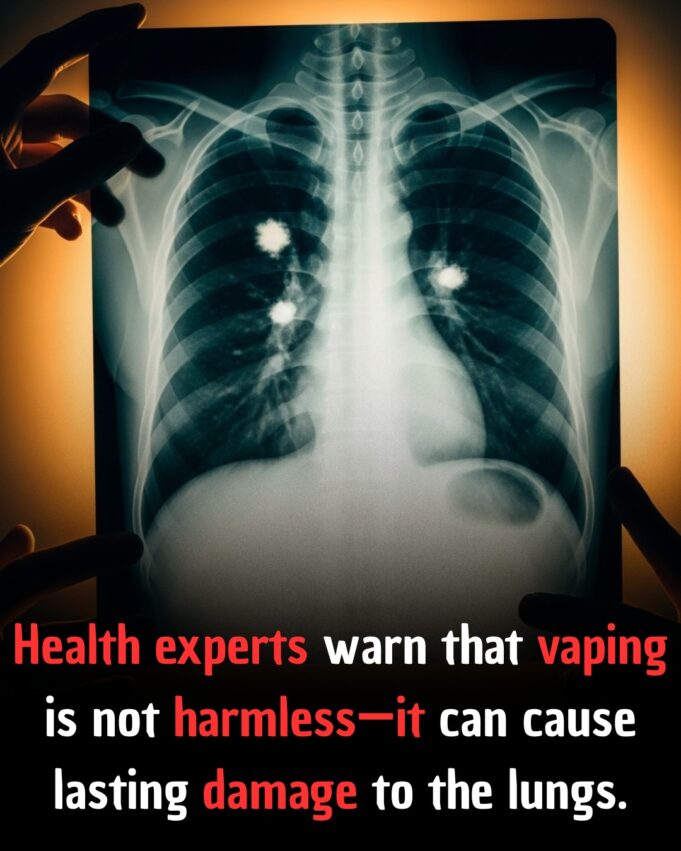 Dampak Kesihatan Vaping: Memahami Risiko pada Paru-paru