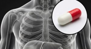 Ubat Baru Berhasil Menetralkan Faktor Risiko Penyakit Jantung Genetik dalam Satu Dos