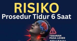 Panduan Perubatan untuk Prosedur Tidur 6 Jam: Fakta dan Nasihat