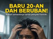 Sehelai Rambut yang Mengubah Segalanya