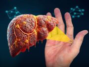 Palmar Erythema: Tanda Amaran Kesihatan dari Tubuh Anda