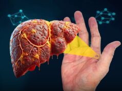 Palmar Erythema: Tanda Amaran Kesihatan dari Tubuh Anda