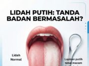 Penghayatan Warisan Bahasa: Semakan Lidah Anda