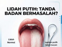 Penghayatan Warisan Bahasa: Semakan Lidah Anda