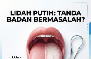 Penghayatan Warisan Bahasa: Semakan Lidah Anda