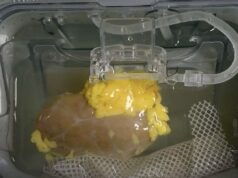 Revolusi Perubatan: Saintis Cipta Buah Pinggang ‘Universal’ Pertama di Dunia