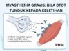 Myasthenia Gravis: Penyakit Jarang dengan Kesan Besar terhadap Kualiti Hidup