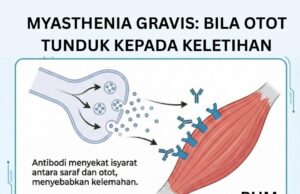 Myasthenia Gravis: Penyakit Jarang dengan Kesan Besar terhadap Kualiti Hidup