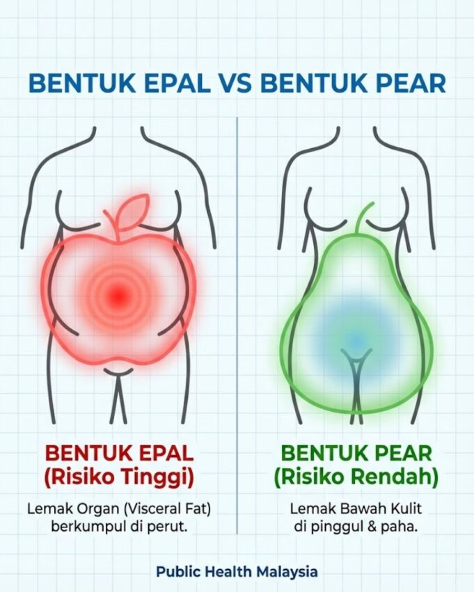 Bahaya Bentuk Epal: Mengapa Kurus tetapi Buncit Menjadi Kebimbangan Saintis
