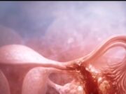 Ectopic Pregnancy: The Hidden Crisis in Women’s Health