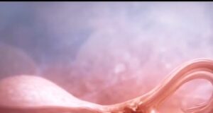 Ectopic Pregnancy: The Hidden Crisis in Women’s Health