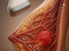 Kaedah Non-Invasif Terbaru untuk Merawat Kanser Payudara Menggunakan Mikrob