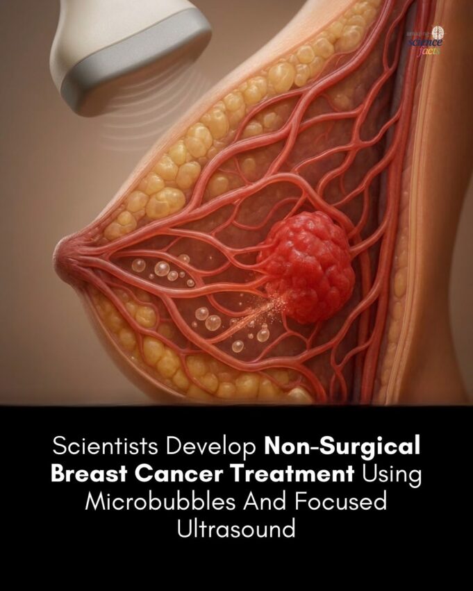 Kaedah Non-Invasif Terbaru untuk Merawat Kanser Payudara Menggunakan Mikrob