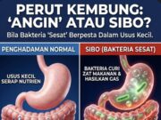 Dilema Perut: Kenali Punca dan Penyelesaian Masalah Sendawa dan Kentut