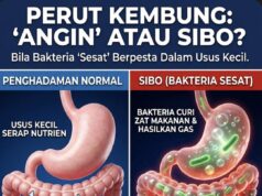 Dilema Perut: Kenali Punca dan Penyelesaian Masalah Sendawa dan Kentut