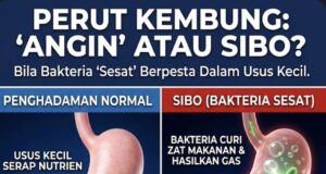 Dilema Perut: Kenali Punca dan Penyelesaian Masalah Sendawa dan Kentut