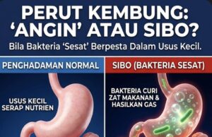 Dilema Perut: Kenali Punca dan Penyelesaian Masalah Sendawa dan Kentut