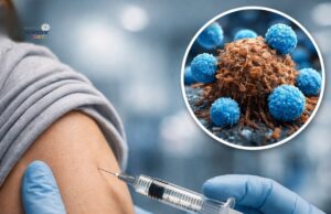 NHS England Perkenal Pendekatan Baru untuk Mempercepat Rawatan Imunoterapi Kanser