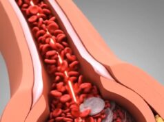 Proses dan Punca Berlakunya Serangan Jantung