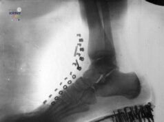 Penemuan Awal X-Ray oleh Nikola Tesla: Kecanggihan Sains 1896