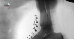 Penemuan Awal X-Ray oleh Nikola Tesla: Kecanggihan Sains 1896