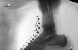 Penemuan Awal X-Ray oleh Nikola Tesla: Kecanggihan Sains 1896