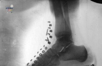 Penemuan Awal X-Ray oleh Nikola Tesla: Kecanggihan Sains 1896