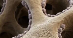 Pemahaman Proses Remodeling Tulang: Mekanisme dan Kepentingannya