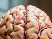 Kesan Tekanan Darah Tinggi Terhadap Kesihatan Otak