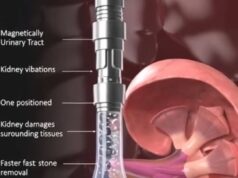 Robot Magnetik Mikroskopik: Inovasi Terbaru dalam Pengubatan Urologi