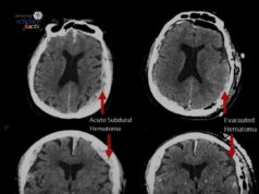 Penyelidikan Sains: Rakaman Tidak Biasa di Hospital