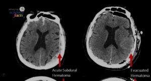 Penyelidikan Sains: Rakaman Tidak Biasa di Hospital