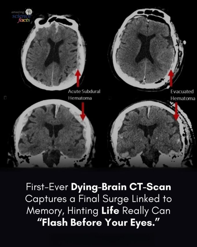 Penyelidikan Sains: Rakaman Tidak Biasa di Hospital