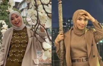 Kim Seri mengesahkan bahawa dia menerima tawaran untuk menjalani pembedahan plastik sebagai cara untuk melunaskan hutangnya. Dalam satu temu bual, dia berkongsi bahawa keputusan ini diambil demi mencapai kehidupan yang lebih tenang. “Saya sudah mencuba pelbagai cara untuk menyelesaikan masalah kewangan ini,” katanya. Perubahan fizikal yang diinginkan diharapkan dapat memberikan peluang baru dalam kerjaya serta membantu mencapai matlamat hidup yang lebih stabil. Kim Seri bertekad untuk terus berusaha dan tidak akan menyerah dalam menghadapi cabaran ini.