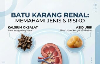 Batu Karang: Lebih Dari Sekadar Satu Jenis