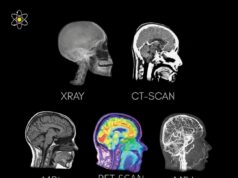 Keberagaman Teknik Imaging Otak: Memilih Alat yang Tepat untuk Diagnosis
