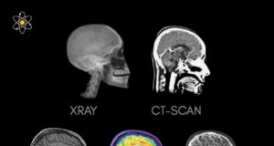 Keberagaman Teknik Imaging Otak: Memilih Alat yang Tepat untuk Diagnosis