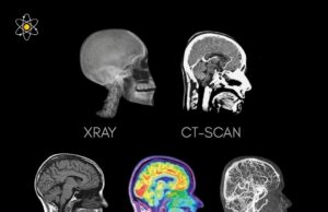 Keberagaman Teknik Imaging Otak: Memilih Alat yang Tepat untuk Diagnosis