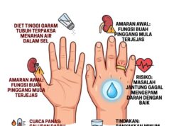 Cincin Terjerut dan Jam Tangan Menjerut: Tanda Amaran Kenaikan Tekanan?