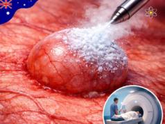 Inovasi Terkini: Liverpool Hospital Perkenal MRI-enaa untuk Peningkatan Penjagaan Kesihatan di Sydney