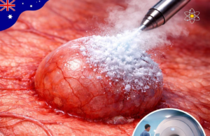 Inovasi Terkini: Liverpool Hospital Perkenal MRI-enaa untuk Peningkatan Penjagaan Kesihatan di Sydney